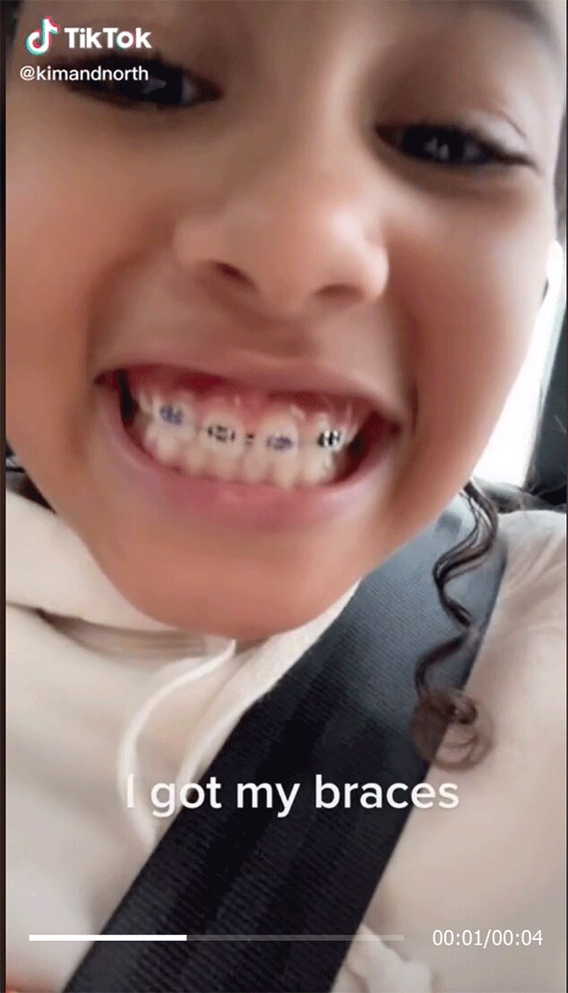 Young Age Play Braces